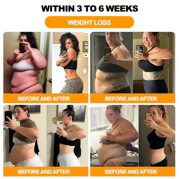 Bee Venom Lymphatic Drainage & Slimming Foot Patches (Set of 10 Patches)